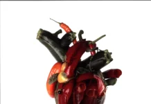 Carcass – Torn Arteries © Carcass - Torn Arteries